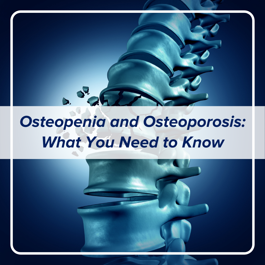 Osteopenia and Osteoporosis: What You Need to Know
