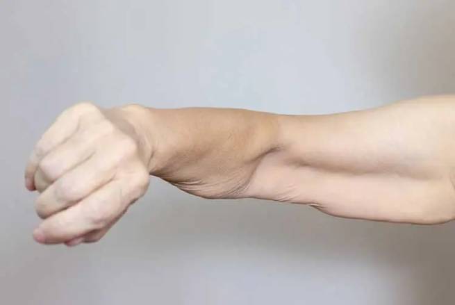 Muscle preservation is essential for lasting weight loss—especially on Ozempic. Learn how protein, collagen, and strength training support metabolism, skin health, and prevent weight regain.